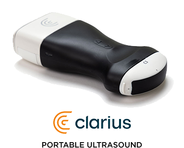clarius portable ultrasound
