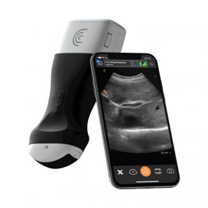 clarius ultrasound